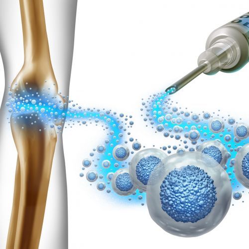 Breakthrough Uses of Stem Cells in Treating Orthopedic Conditions, AgeRejuvenation in Tampa Bay and Central Florida