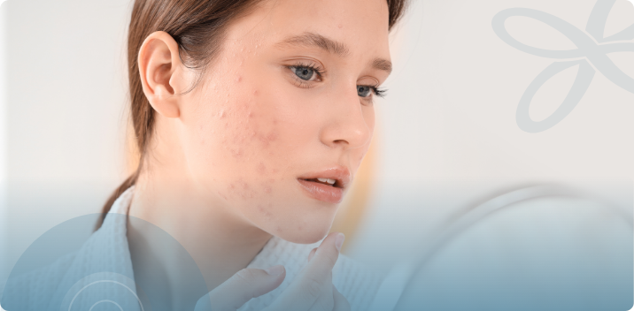 Gut Health Testing for Acne in Winter Garden: What Inflammation and Diagnostics Can Reveal, AgeRejuvenation in Tampa Bay and Central Florida