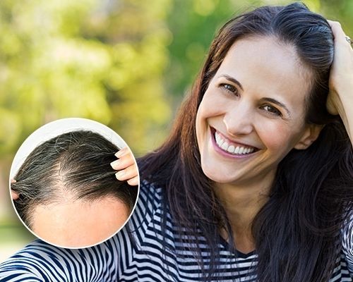 Repairing Hair Loss: Stem Cell Therapy for Hair Loss, AgeRejuvenation in Tampa Bay and Central Florida