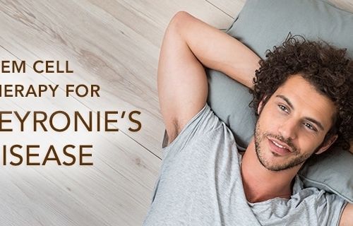 Stem Cell Therapy for Peyronie’s Disease, AgeRejuvenation in Tampa Bay and Central Florida