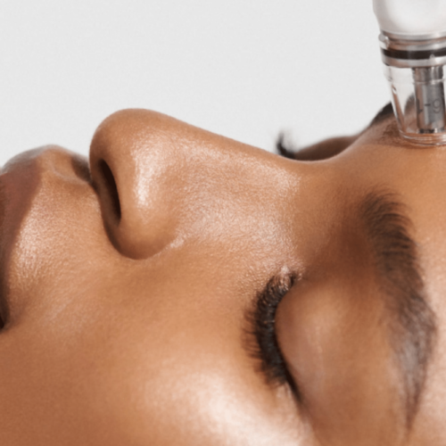 The Sweet Truth about Chocolate, AgeRejuvenation in Tampa Bay and Central Florida
