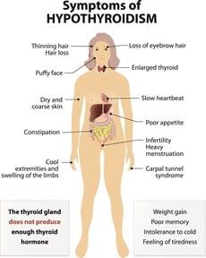 Thyroid may be to blame!, AgeRejuvenation in Tampa Bay and Central Florida