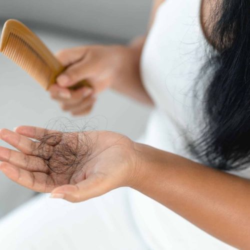 What Hair Loss is Telling You About Your Hormone Levels, AgeRejuvenation in Tampa Bay and Central Florida